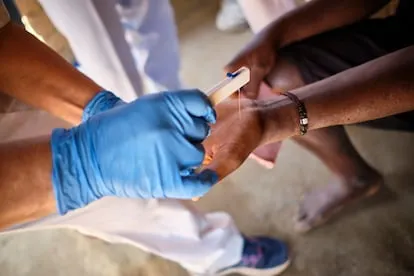 Al menos 130 pacientes reciben tratamiento por lepra en RD